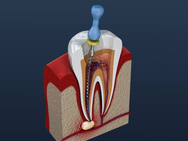 ELAINE DENTAL HOME EDAVANNA